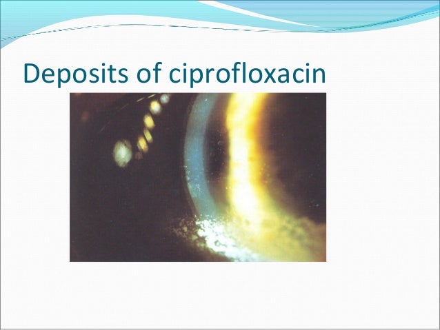 Chlamydia Treatment With Ciprofloxacin M Ulcer definition of ulcer by Medical dictionary